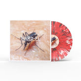 Sweating Someone Else's Fever - Hard-Fi [VINYL]